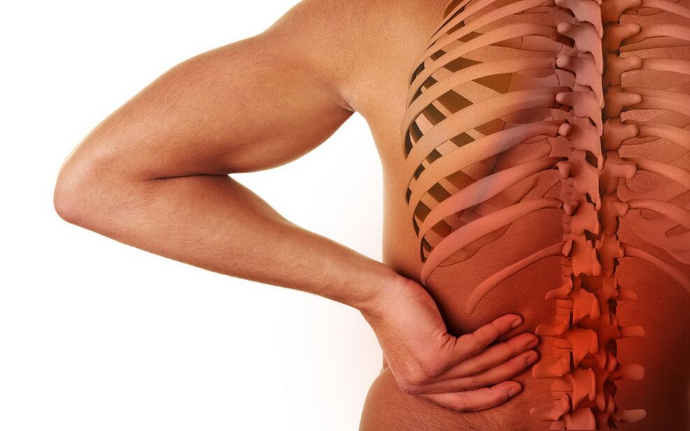 osteokondroosist tingitud seljavalu