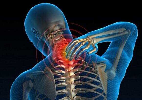 osteokondroosist tingitud kaelavalu