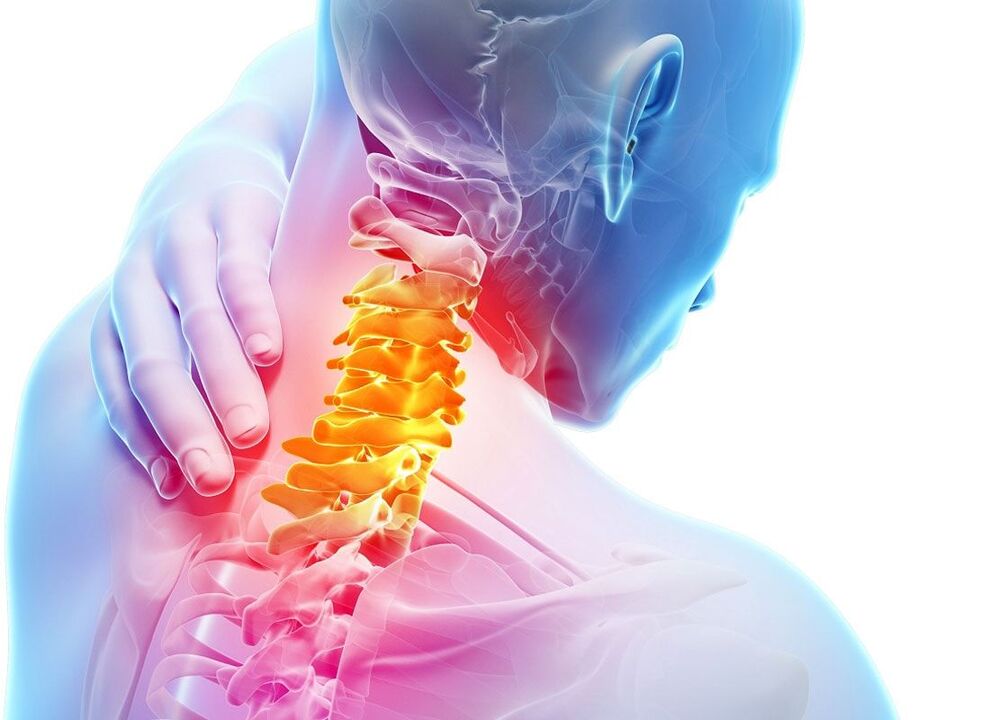 osteokondroosi lokaliseerimine